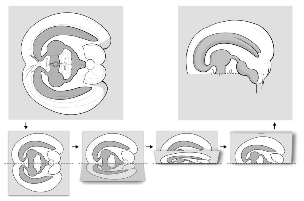 Illustration Schematische Rekonstruktion von Leonardos „geöffneter“ Präparation eines Gehirns
